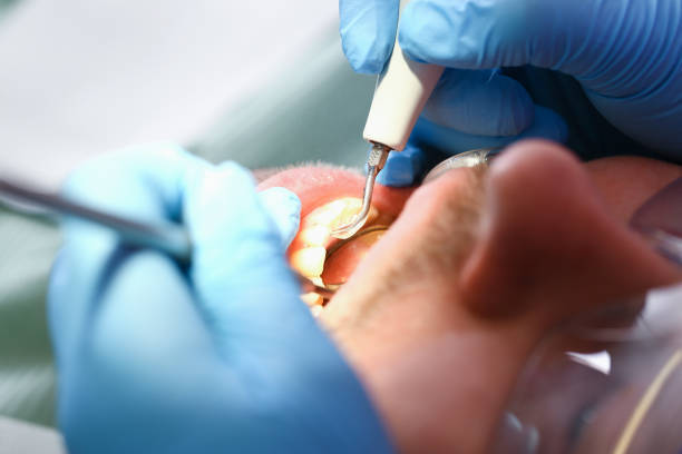 Best Emergency Dental Care for Abscessed Tooth in Walton Hills, OH