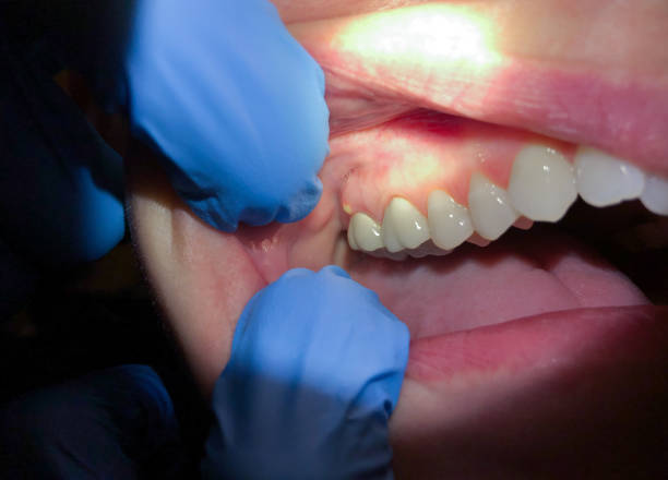Best Emergency Dental Services for Seniors in Walton Hills, OH